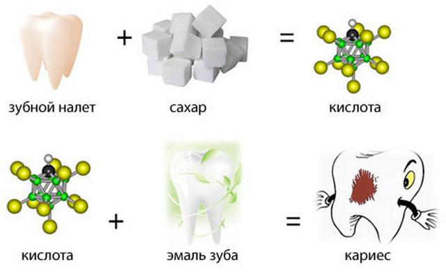 причины кариеса