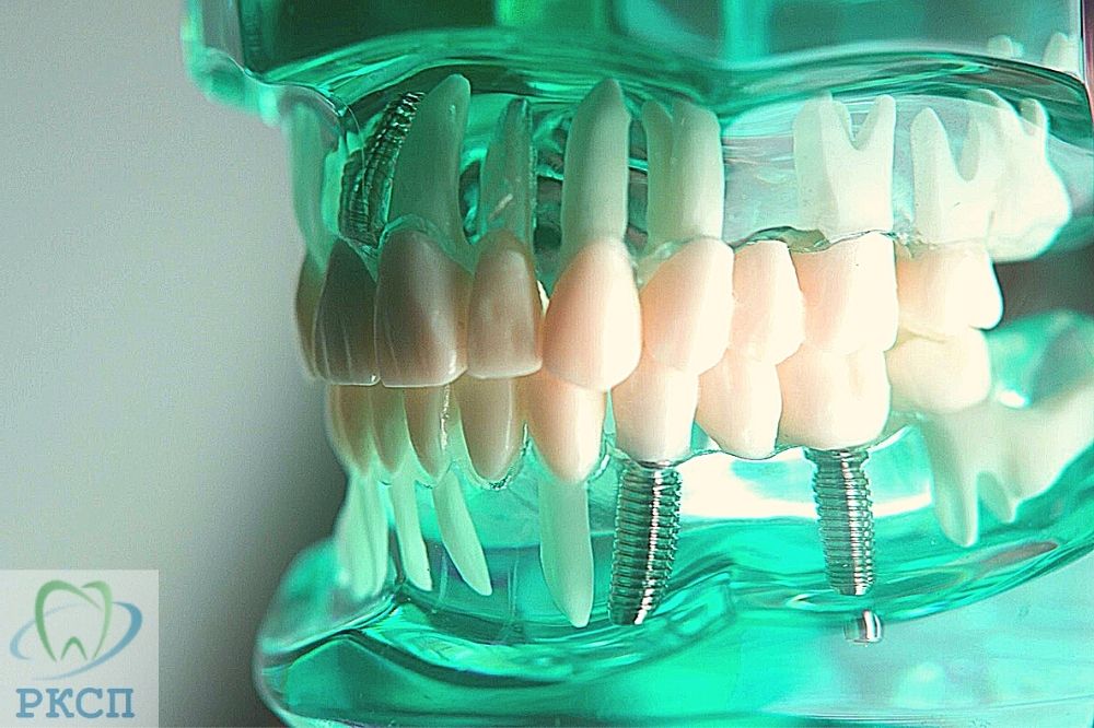 акриловые зубные протезы